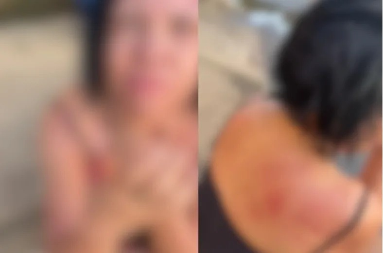 Homem é preso após atacar companheira com faca no Setor Campinas