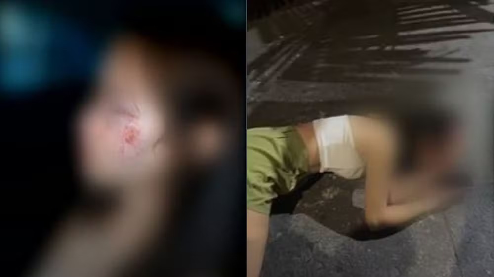 Mulher é atacada enquanto saia de uma boate no Setor Guanabara, em Goiânia