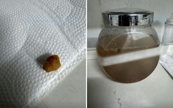 Polícia investiga morte de bebê de 1 ano após suspeita de engasgamento com pedra de crack em Goiás