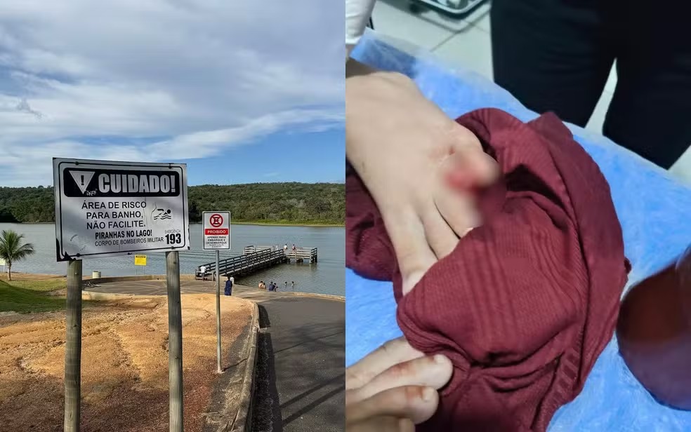 Criança perde parte do dedo após ataque de piranhas em Caldas Novas