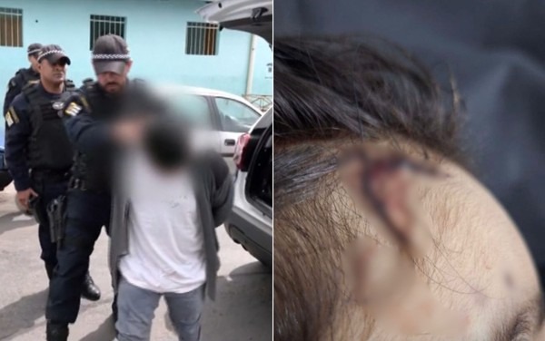 Menina de 2 anos morre após dar entrada em unidade de saúde com sinais de agressão em Goiás
