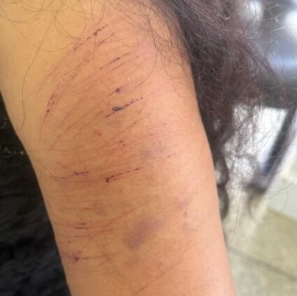 Homem é preso após descumprir medida protetiva e atacar ex-companheira em Luziânia