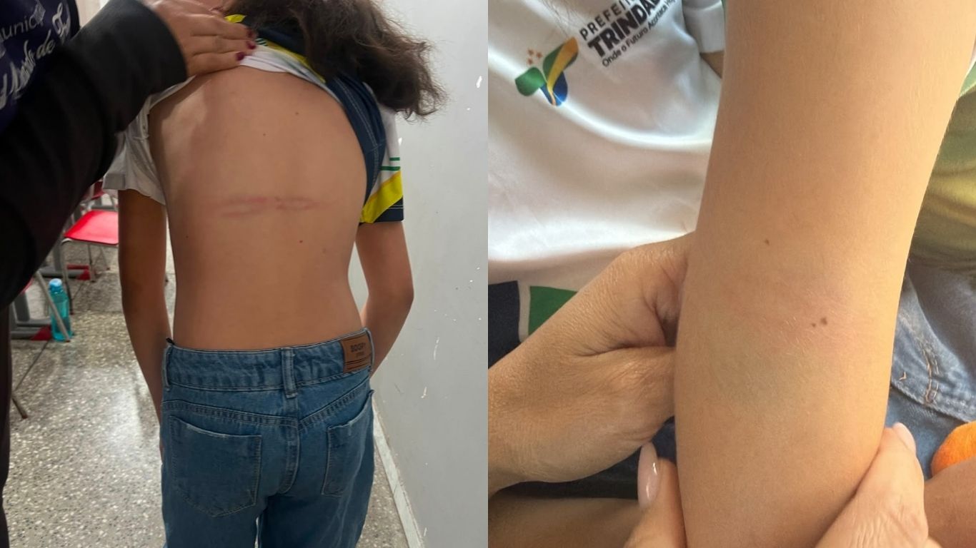Mãe é presa em flagrante suspeita de agredir filhas de 7 e 9 anos com cabo de rodo em Trindade