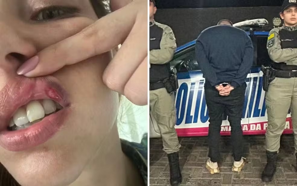 Empresário é preso após mulher denunciar agressões e ter dentes traumatizado, em Goiânia