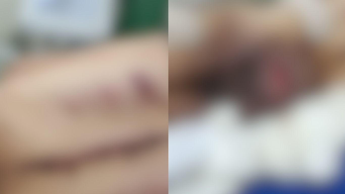 Idoso é encontrado em estado crítico e filho adotivo acaba preso por suspeita de maus-tratos em Goiânia