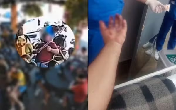 Torcedor tem mão dilacerada após explosão de rojão durante comemoração em bar de Jaraguá