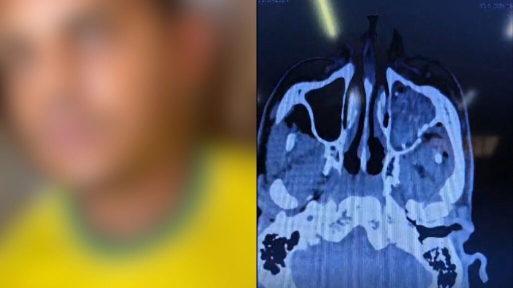 Jovem é preso pela Rotam após confessar tentativa de homicídio por dívida de R$ 1,5 mil em Goiânia: "fui eu mesmo"