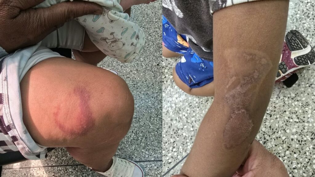 Jovem é presa suspeita de queimar filhos com ferro de passar e ameaçar a própria mãe em Aparecida de Goiânia