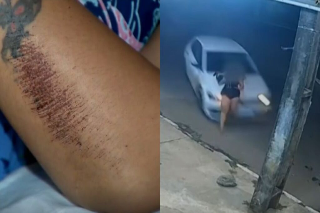 “Tudo que eu queria era acabar com aquele filme de terror, porque ali eu não ia sair viva”, diz vítima após ser atropelada duas vezes por ex-companheiro, em Aparecida de Goiânia