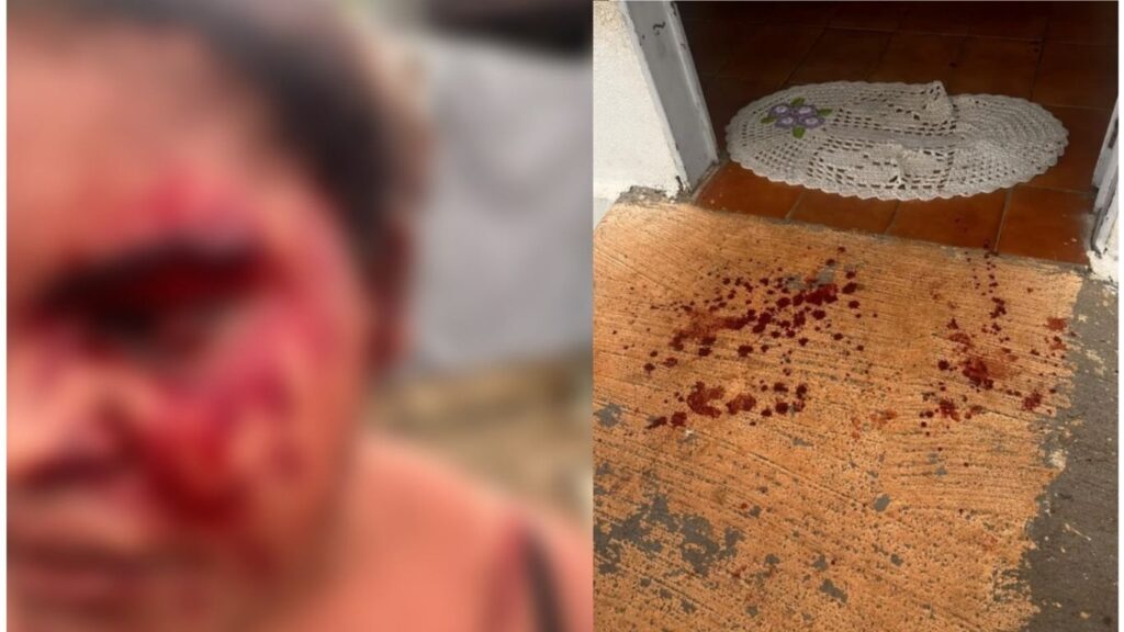 Mulher é encontrada ensanguentada e ferida após suposta agressão e homem com mandado de prisão é detido em Uruaçu