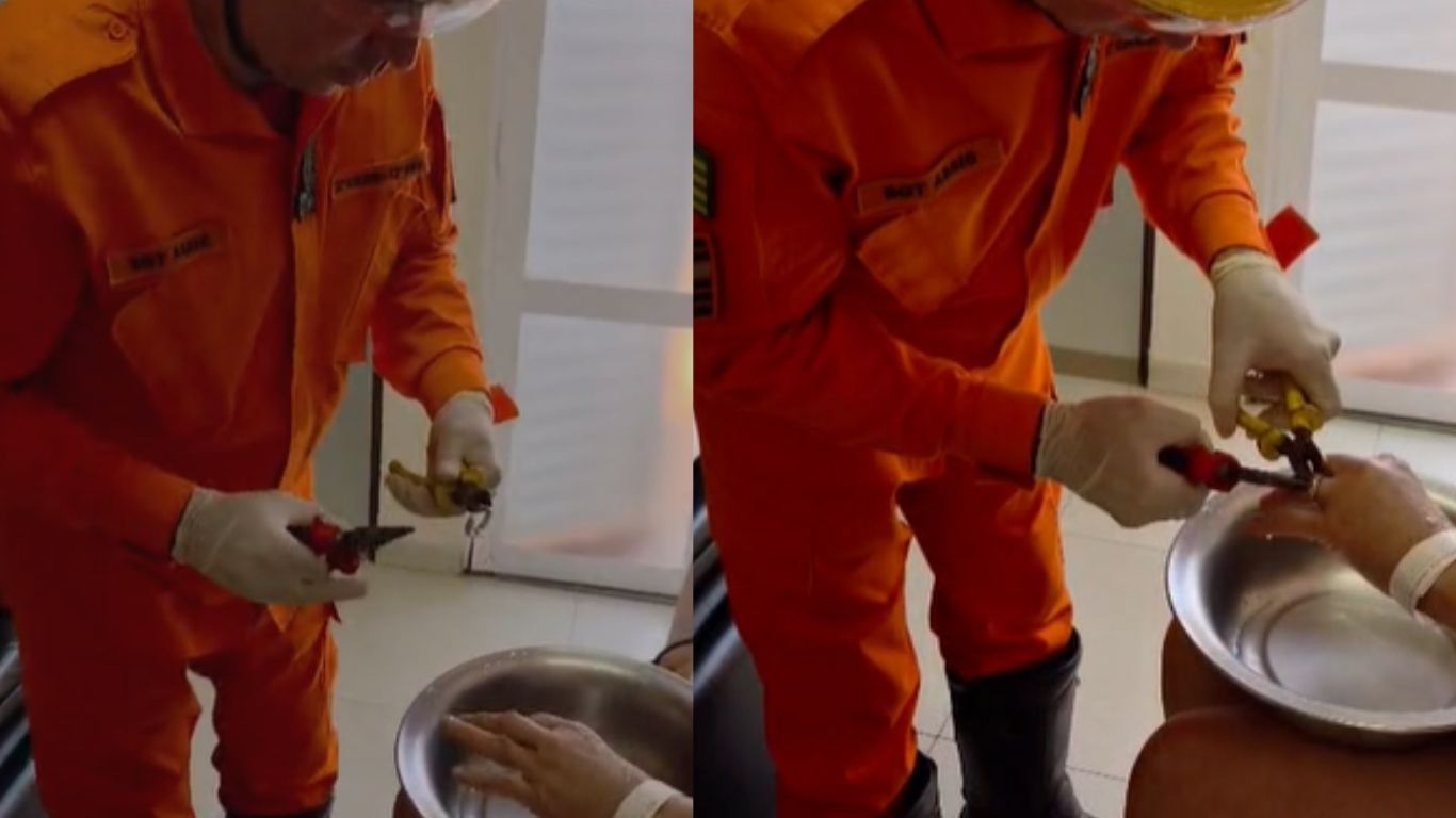 Aliança fica presa em dedo de paciente e mobiliza equipe dos Bombeiros em Jataí
