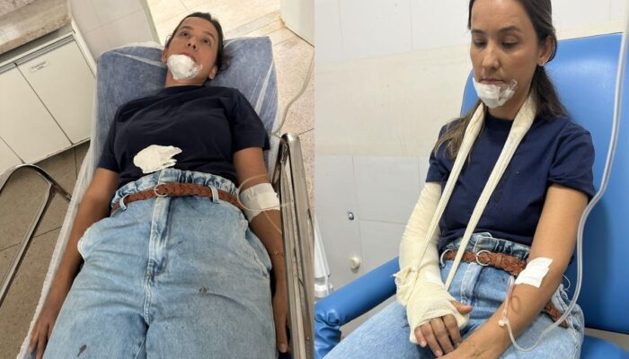 Empresária de Itaberaí sofre queda grave e médica faz alerta