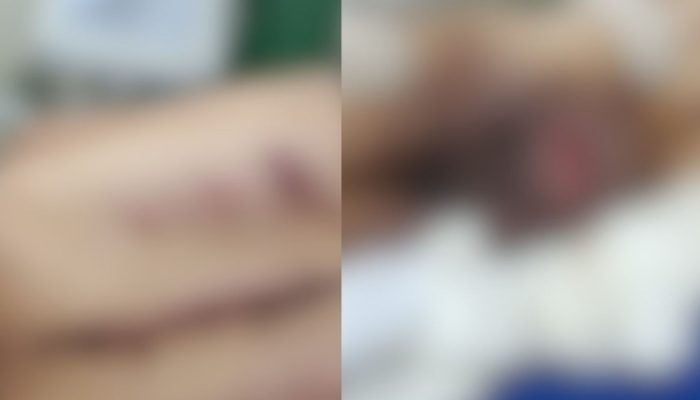 Idoso é encontrado em estado crítico e filho adotivo acaba preso por suspeita de maus-tratos em Goiânia