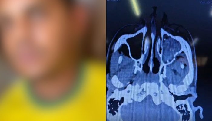 Jovem é preso pela Rotam após confessar tentativa de homicídio por dívida de R$ 1,5 mil em Goiânia: "fui eu mesmo"