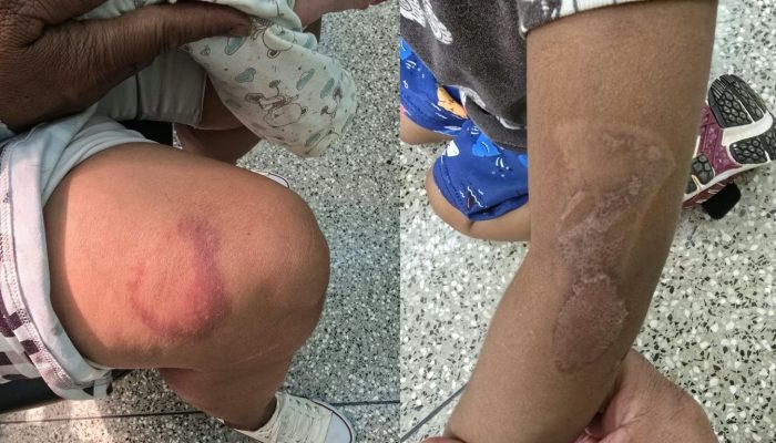 Jovem é presa suspeita de queimar filhos com ferro de passar e ameaçar a própria mãe em Aparecida de Goiânia