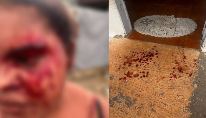 Mulher é encontrada ensanguentada e ferida após suposta agressão e homem com mandado de prisão é detido em Uruaçu