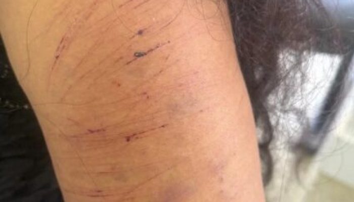 Homem é preso após descumprir medida protetiva e atacar ex-companheira em Luziânia