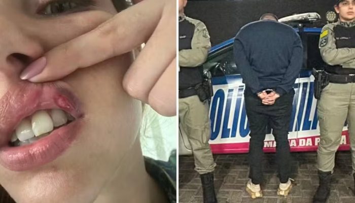 Empresário é preso após mulher denunciar agressões e ter dentes traumatizado, em Goiânia