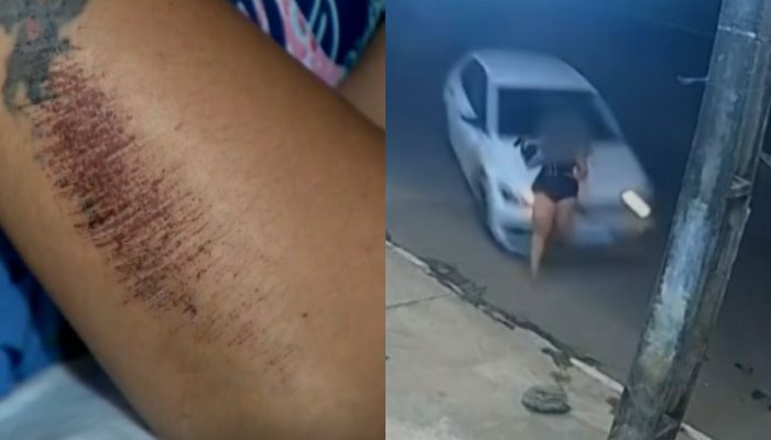 “Tudo que eu queria era acabar com aquele filme de terror, porque ali eu não ia sair viva”, diz vítima após ser atropelada duas vezes por ex-companheiro, em Aparecida de Goiânia