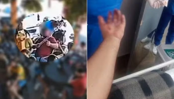 Torcedor tem mão dilacerada após explosão de rojão durante comemoração em bar de Jaraguá