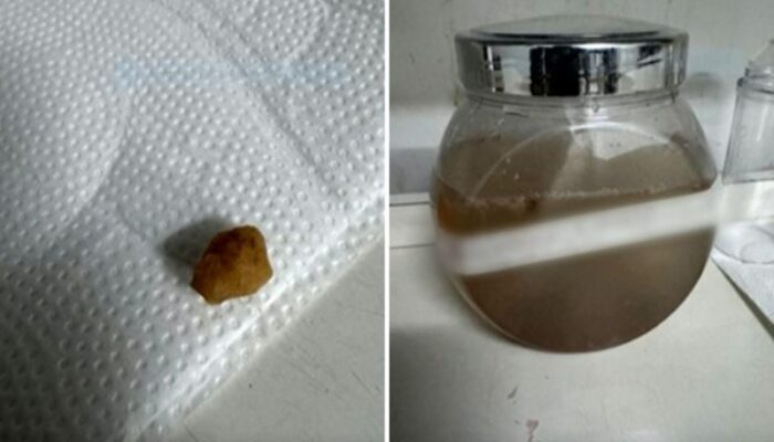 Polícia investiga morte de bebê de 1 ano após suspeita de engasgamento com pedra de crack em Goiás