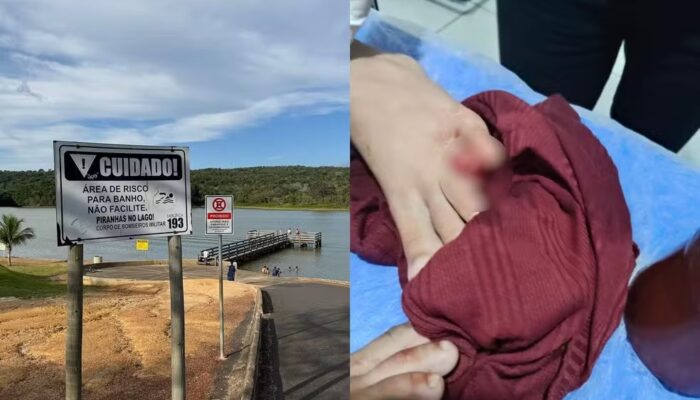 Criança perde parte do dedo após ataque de piranhas em Caldas Novas